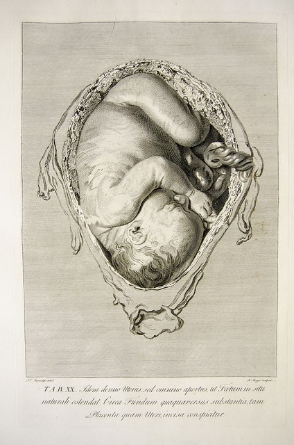 baby-womb-sketch-univ.liverpool
